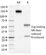 S100A4/Metastasin/Calvasculin (Marker of Tumor Metastasis) Antibody in SDS-PAGE (SDS-PAGE)