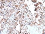 S100A4/Metastasin/Calvasculin Antibody in Immunohistochemistry (Paraffin) (IHC (P))