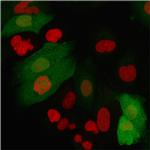 S100A4/Metastasin/Calvasculin Antibody in Immunocytochemistry (ICC/IF)