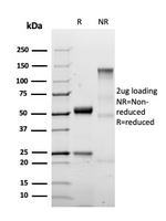 S100A4/Metastasin/Calvasculin Antibody in SDS-PAGE (SDS-PAGE)