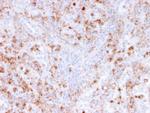 Calprotectin/MRP14/S100A9/Calgranulin B Antibody in Immunohistochemistry (Paraffin) (IHC (P))