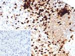 Calprotectin/MRP14/S100A9/Calgranulin B Antibody in Immunohistochemistry (Paraffin) (IHC (P))