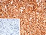 Calprotectin/MRP14/S100A9/Calgranulin B Antibody in Immunohistochemistry (Paraffin) (IHC (P))