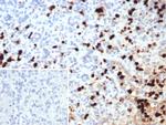 Calprotectin/MRP14/S100A9/Calgranulin B Antibody in Immunohistochemistry (Paraffin) (IHC (P))