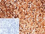 Calprotectin/MRP14/S100A9/Calgranulin B Antibody in Immunohistochemistry (Paraffin) (IHC (P))