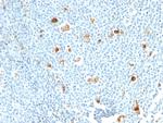 Calprotectin/MRP14/S100A9/Calgranulin B Antibody in Immunohistochemistry (Paraffin) (IHC (P))
