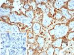 S100A12/CGRP Antibody in Immunohistochemistry (Paraffin) (IHC (P))