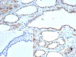 S100A13 (S100 Calcium Binding Protein A13) Antibody in Immunohistochemistry (Paraffin) (IHC (P))