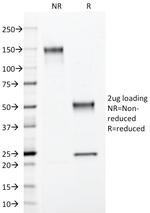 S100B (Astrocyte and Melanoma Marker) Antibody in SDS-PAGE (SDS-PAGE)