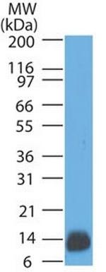 S100B (Astrocyte and Melanoma Marker) Antibody in Western Blot (WB)