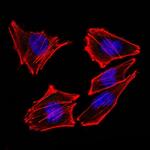 S100B (Astrocyte and Melanoma Marker) Antibody in Immunocytochemistry (ICC/IF)