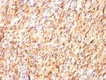 S100B (Astrocyte and Melanoma Marker) Antibody in Immunohistochemistry (Paraffin) (IHC (P))