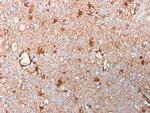 S100B Antibody in Immunohistochemistry (Paraffin) (IHC (P))