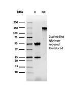 S100B Antibody in SDS-PAGE (SDS-PAGE)