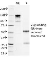 Serum Amyloid A Antibody in SDS-PAGE (SDS-PAGE)