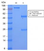 Serum Amyloid A Antibody in SDS-PAGE (SDS-PAGE)