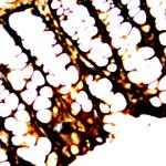 ZO-2 Antibody in Immunohistochemistry (Paraffin) (IHC (P))