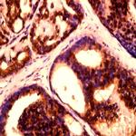 Phospho-L1CAM (Ser1152) Antibody in Immunohistochemistry (Paraffin) (IHC (P))