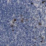 CRTC-3 Antibody in Immunohistochemistry (Paraffin) (IHC (P))