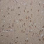 Parkin Antibody in Immunohistochemistry (Paraffin) (IHC (P))