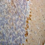 PINK1 Antibody in Immunohistochemistry (Paraffin) (IHC (P))