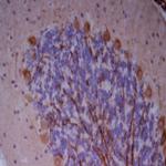 PINK1 Antibody in Immunohistochemistry (Paraffin) (IHC (P))