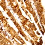 DCLK1 Antibody in Immunohistochemistry (Paraffin) (IHC (P))