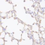 ALDH1a1 Antibody in Immunohistochemistry (Paraffin) (IHC (P))