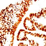 SNAI-1 Antibody in Immunohistochemistry (Paraffin) (IHC (P))