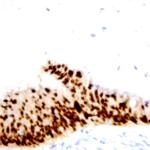 SNAIL-1, 2, 3 Antibody in Immunohistochemistry (Paraffin) (IHC (P))