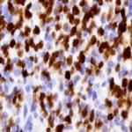 TWIST1/2 Antibody in Immunocytochemistry (ICC/IF)