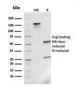 Monocyte Chemotactic Protein 2 (MCP2)/CCL8 Antibody in SDS-PAGE (SDS-PAGE)