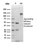 Monocyte Chemotactic Protein 2 (MCP2)/CCL8 Antibody in Immunoelectrophoresis (IE)