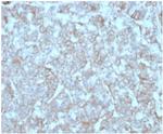 Monocyte Chemotactic Protein 2 (MCP2)/CCL8 Antibody in Immunohistochemistry (Paraffin) (IHC (P))