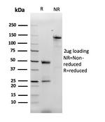 Monocyte Chemotactic Protein 2 (MCP2)/CCL8 Antibody in SDS-PAGE (SDS-PAGE)