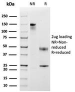 Monocyte Chemotactic Protein 2 (MCP2)/CCL8 Antibody in SDS-PAGE (SDS-PAGE)
