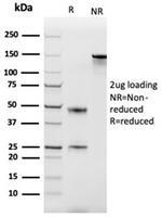 Monocyte Chemotactic Protein 2 (MCP2)/CCL8 Antibody in SDS-PAGE (SDS-PAGE)