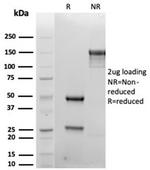 CD138/Syndecan-1 (SDC1) (Plasma Cell Marker) Antibody in SDS-PAGE (SDS-PAGE)