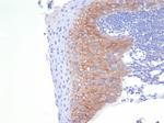 CD138/Syndecan-1 (SDC1) (Plasma Cell Marker) Antibody in Immunohistochemistry (Paraffin) (IHC (P))