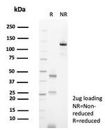 CD138/Syndecan-1 (SDC1) (Plasma Cell Marker) Antibody in SDS-PAGE (SDS-PAGE)