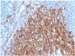 CD138/Syndecan-1 (SDC1) (Plasma Cell Marker) Antibody in Immunohistochemistry (Paraffin) (IHC (P))