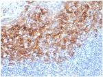 CD138/Syndecan-1 (SDC1) (Plasma Cell Marker) Antibody in Immunohistochemistry (Paraffin) (IHC (P))