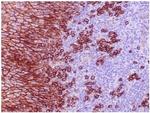 CD138/Syndecan-1 (SDC1) (Plasma Cell Marker) Antibody in Immunohistochemistry (Paraffin) (IHC (P))