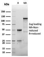 CD138/Syndecan-1 (SDC1) (Plasma Cell Marker) Antibody in SDS-PAGE (SDS-PAGE)