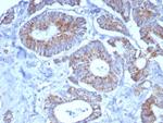 SDHA (Succinate Dehydrogenase Complex Flavoprotein Subunit A) Antibody in Immunohistochemistry (Paraffin) (IHC (P))