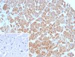 SDHA (Succinate Dehydrogenase Complex Flavoprotein Subunit A) Antibody in Immunohistochemistry (Paraffin) (IHC (P))