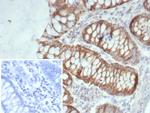 SDHA (Succinate Dehydrogenase Complex Flavoprotein Subunit A) Antibody in Immunohistochemistry (Paraffin) (IHC (P))