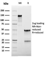 CD62L (L-Selectin) Antibody in SDS-PAGE (SDS-PAGE)