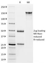 VISTA/GI24 (Negative Regulator of Immune Response) Antibody in SDS-PAGE (SDS-PAGE)