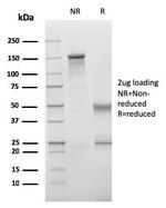 VISTA/GI24 (Negative Regulator of Immune Response) Antibody in SDS-PAGE (SDS-PAGE)